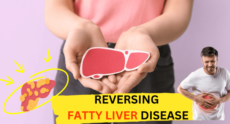 reverse fatty liver