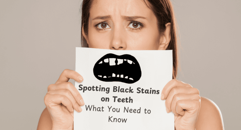 Black stains on teeth