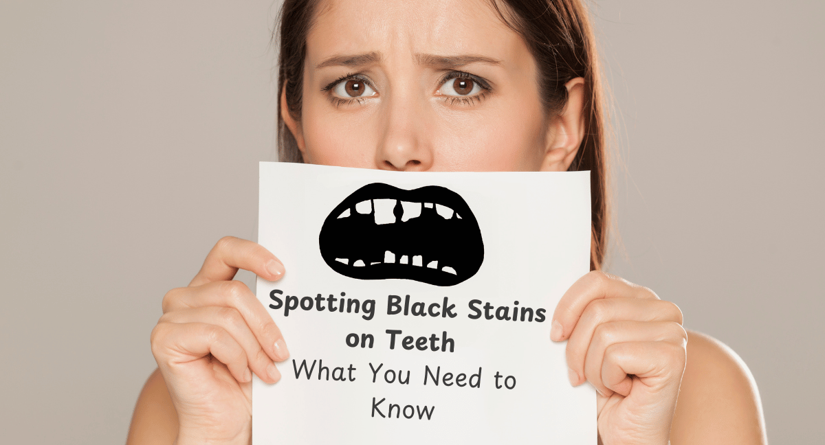 Black stains on teeth