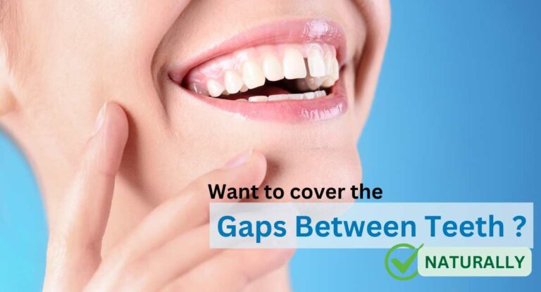 gaps between teeth