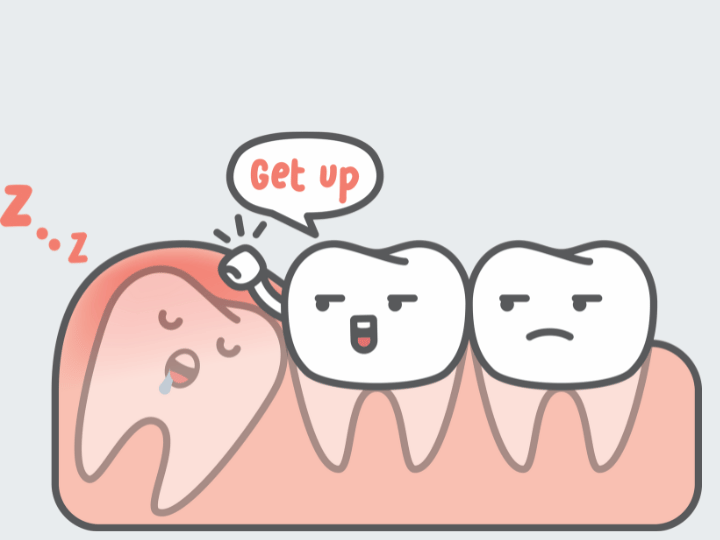 Benefits of keeping wisdom teeth